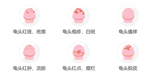 龟头有炎症检查第一位治疗不规范不止两行泪