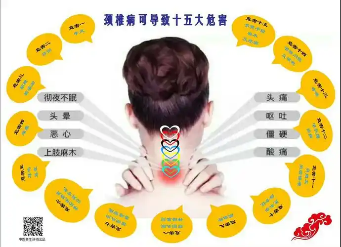 原来颈椎病有这些症状,不看不知道一看吓一跳!(副本)