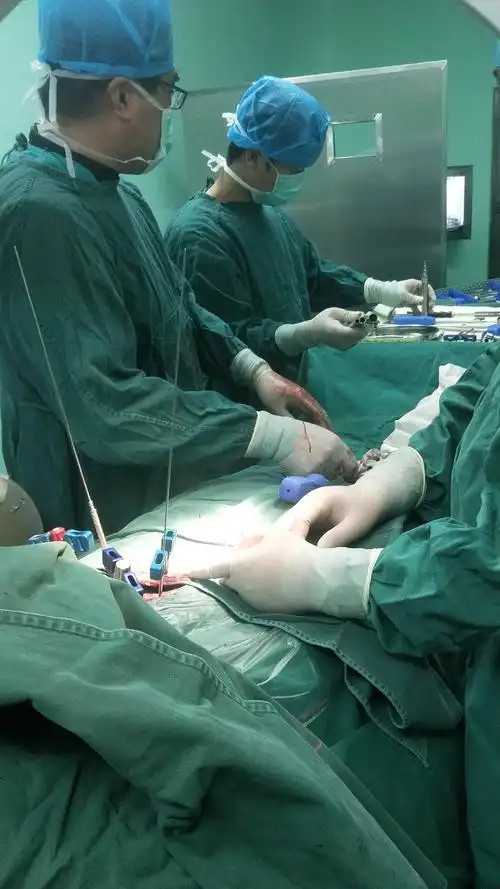 我院骨科首例微创腰椎骨折椎弓根钉内固术 写美篇  腰部骨折微创手术