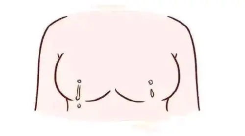 乳房疾病系列之王医生浅谈乳腺纤维瘤2