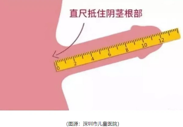 外牵拉至最大长度,测量阴茎头顶端(不是包皮末端)距离阴茎根部的距离