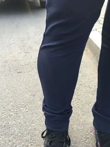 这种小腿肚向外撇着的粗怎么办