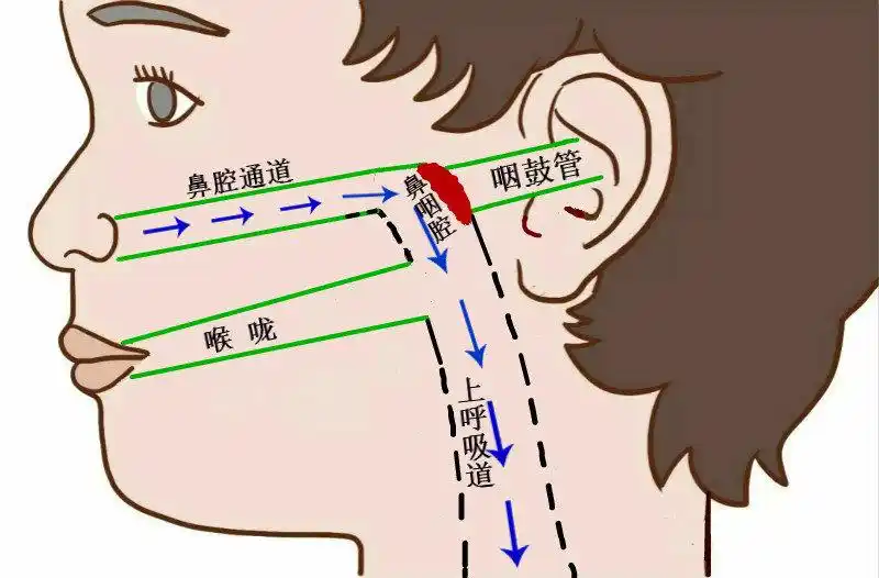 为什么肥大就惹祸?_小儿腺样体肥大_疾病介绍_介绍 - 好大夫在线