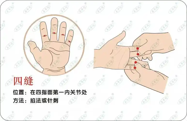 掐揉四缝