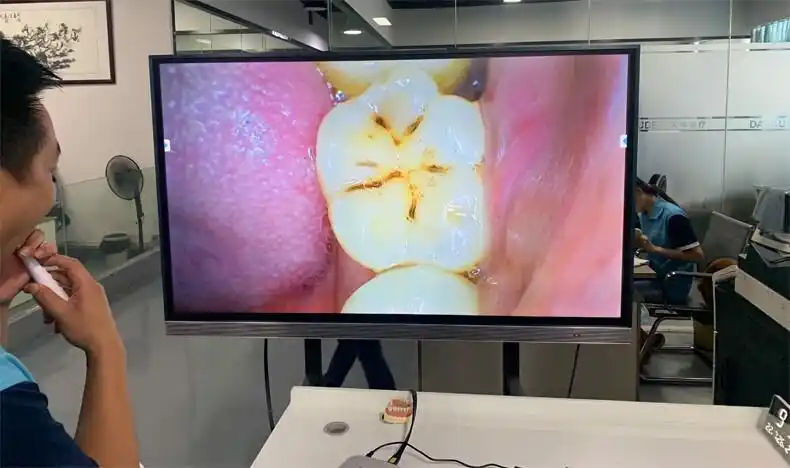 usb口腔内窥镜牙科便携式移动无线手柄电脑手机平板ipad电视机屏 有线