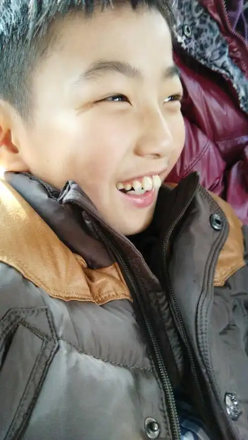 男孩由帅变丑是怎样一种体验?