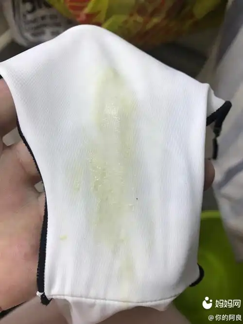 这个颜色的白带正常吗 还有异味 查白带又没有问题