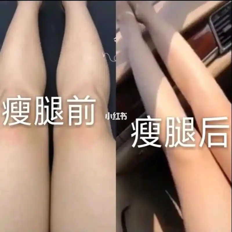 强烈推荐吴昕代言的这款瘦身减肥糖果我以一个减肥成功人士的角度给