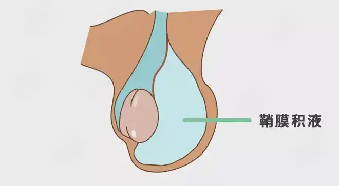 睾丸|隐睾症|阴囊|腹腔_网易订阅