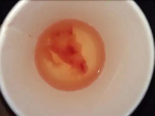 药流第二天 掉出来的 本来是血块放杯子里水浸成这样是胎囊吗