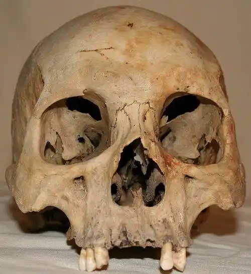 com人头骨骨骼骨头人体骨骼图片tupian114.