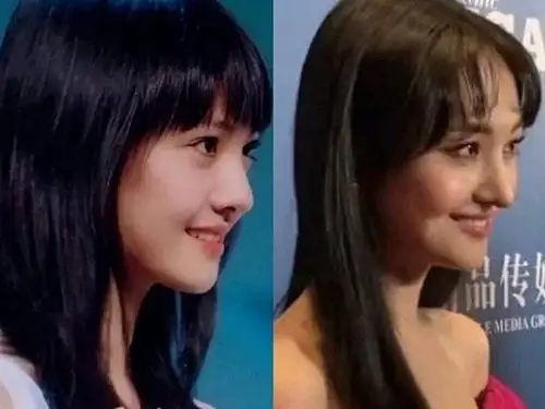 心疼郑爽,因为鼻子毁了一张脸.真的挺心疼爽妹儿的.