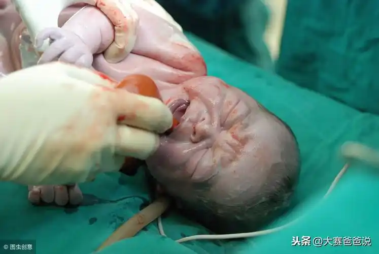 刚出生的婴儿到底是什么样子呢?来一起看看婴儿出生的那一刻吧