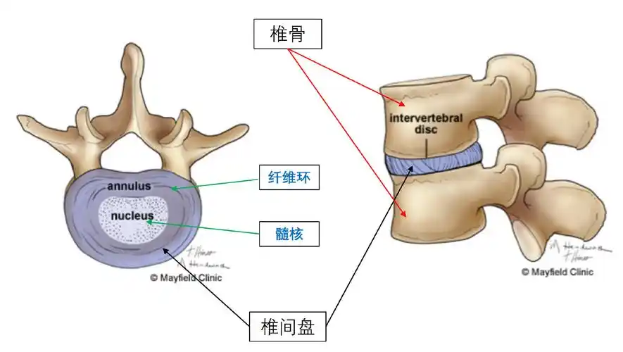 腰椎间盘突出(lhd)自我修复手册(精编)