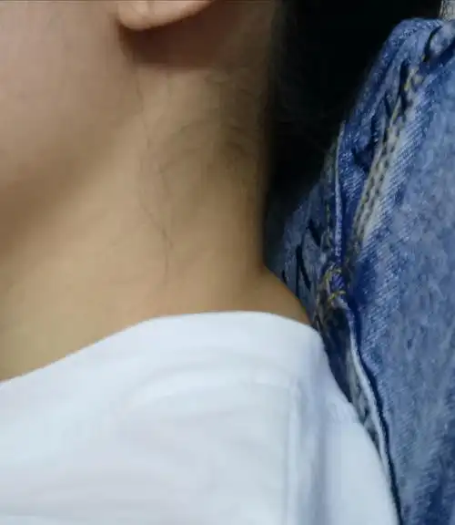 看看我吧01010101我连躺着脖子后面的肉都不平这富贵包要怎么