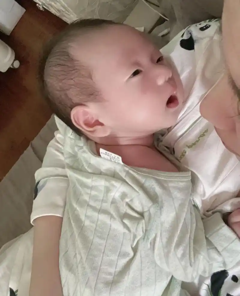 满月的宝宝尿道下裂,医生说越早做越好.