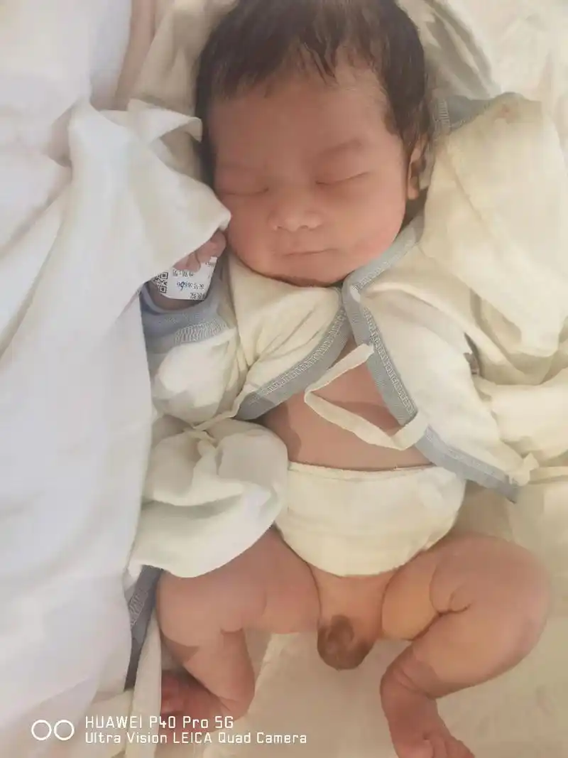 刚出生宝宝