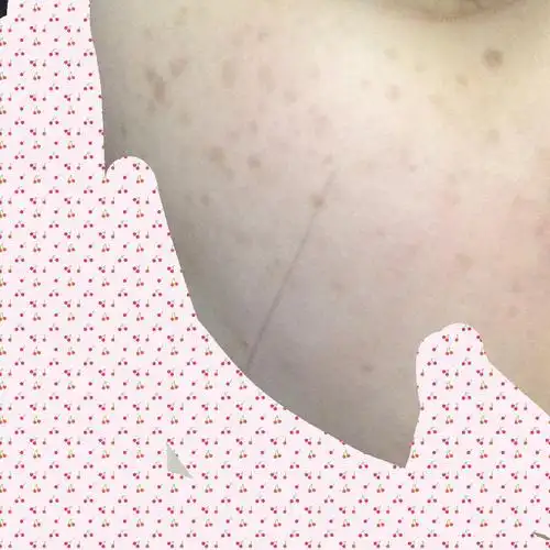 请问这是什么斑?常熬夜,生活习惯不太好,饮食口味重.