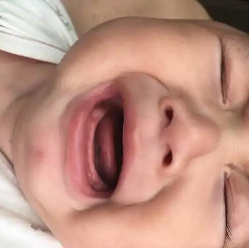 宝宝没长牙也需要清洁口腔,口腔护理六个误区,你中了几个