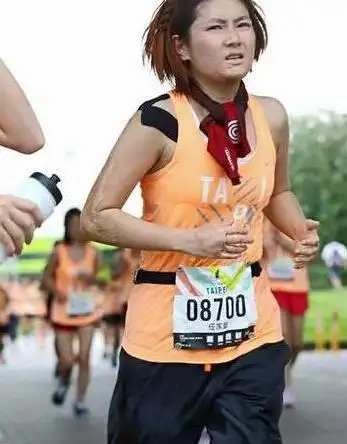 selina身上烧伤前后对比惨不忍睹 大方展露疤痕获赞正能量女神