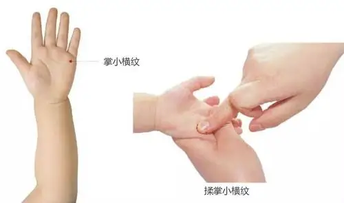 小儿推拿穴位知识小横纹与掌小横纹