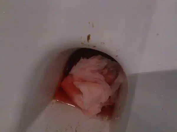 每天早上都会肚子疼,胀,拉血,拉完肚子 肺痛后拉血,拉完后就会好, 拉