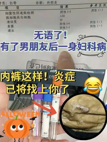 妇科炎症一定早点筛查后悔都来不及大