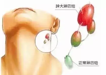 健康脖子长小肉粒说明啥问题