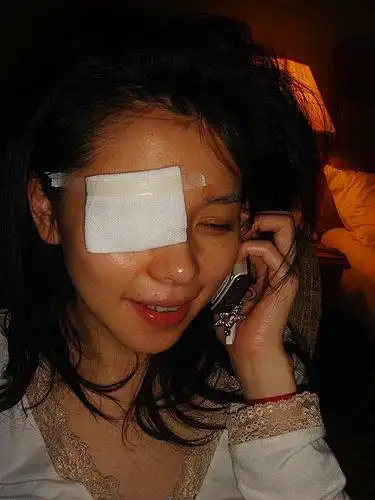 徐若独眼龙照首曝光否认被歌迷砸伤