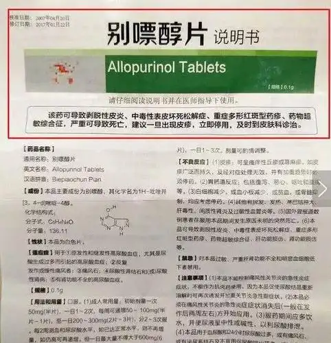 别嘌醇的这个副作用,严重可致死亡!很多人却不当回事