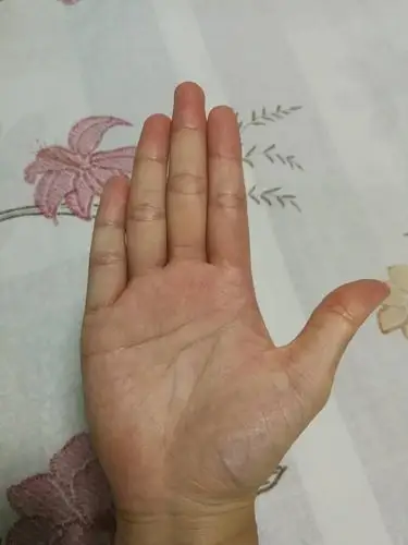 有哪位大师看看这手相,说是孤独终老的手相,真的吗?何时结婚呢?