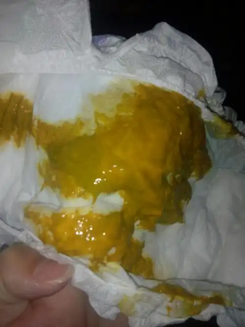 宝妈们帮我看看,宝宝拉屎正常吗