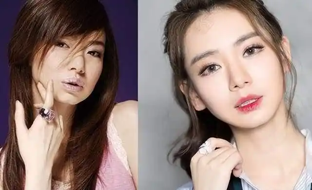 从"普普通通"到"美若天仙",这3位女明星,整容很成功