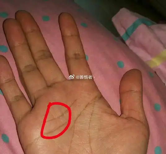 感情线断开,多是二婚命!首先,感情线中断,就预示着你的感情上有波折.