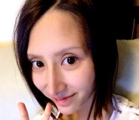 鼻子当场塌陷!女星整容失败惨不忍睹