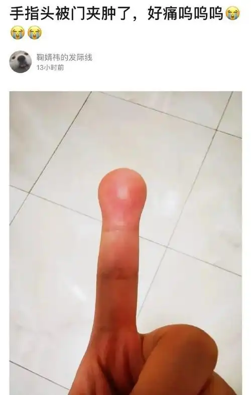 家里小母猫初发情,夜夜惨叫实在没有办法,昨日用棉签沾润滑油帮她解决