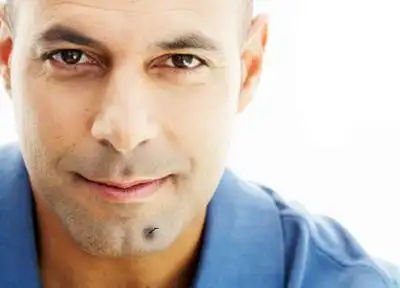 痣上长毛是活痣,从美学角度讲痣长在脸上本来就对影响形象美观有一定