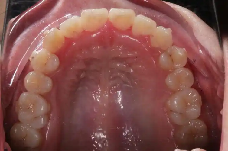 口腔医生须知资料收集正畸患者摄影资料的采集