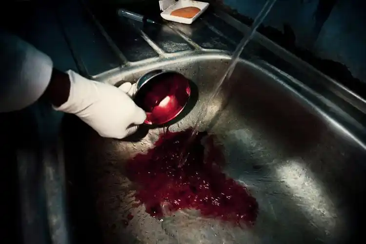 肯尼亚非法堕胎的受害女性组图