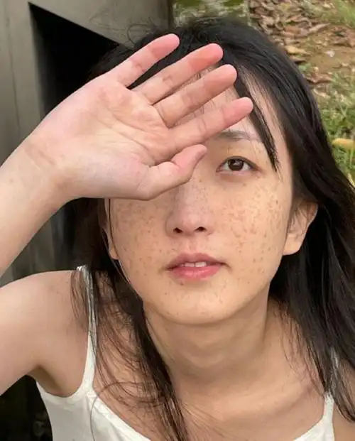 女演员满脸雀斑因气质特殊被导演看中,大方展示雀斑被夸电影脸