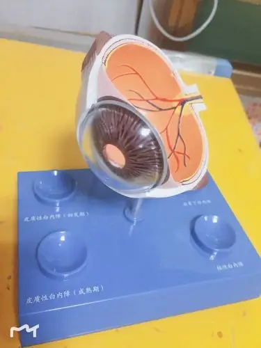 赵医生还给我们精心准备了眼球的解剖模具,展示了医学的严谨与细致.
