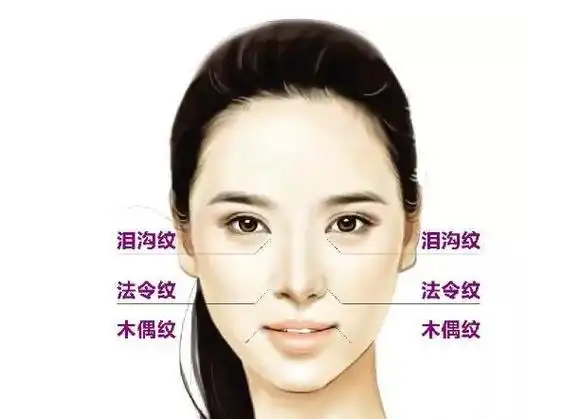 除了法令纹,泪沟纹,木偶纹也是让你显老的元凶,这三组"八"字样的