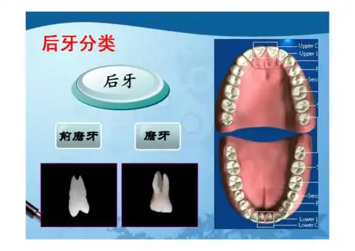 恒牙解剖后牙pdf82页