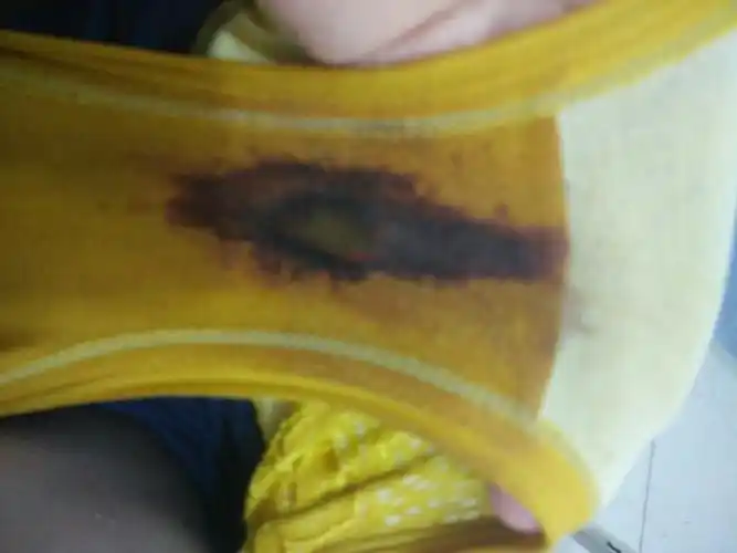 这是月经来了吗?