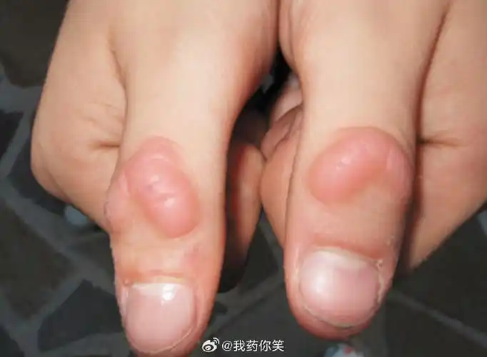 全民科学用药提升计划##科学用药笔记##心理科