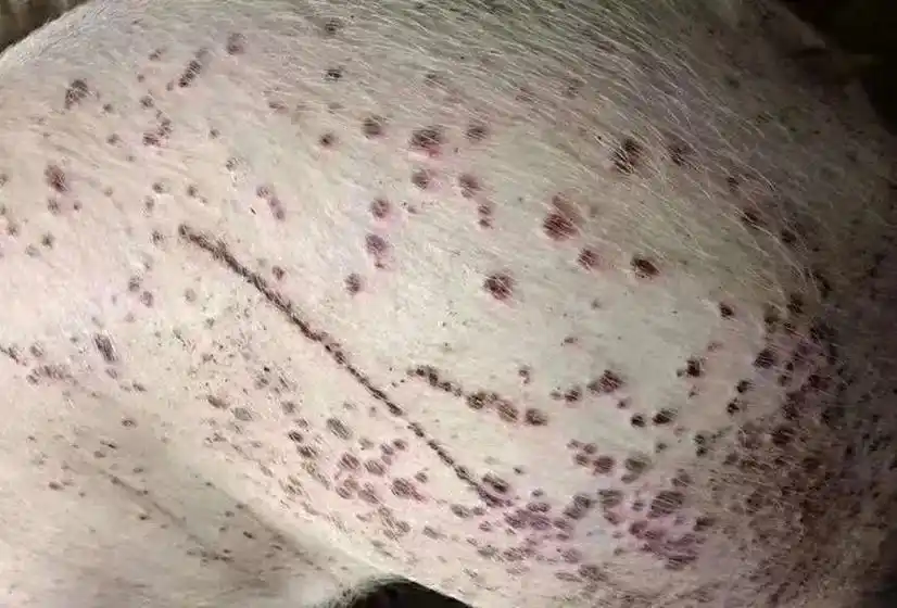 天气热了,这种情况越来越多,身上,红疙瘩红点点,猪痘痘