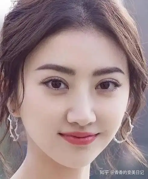 景甜换掉悲伤蛙双眼皮后又美出了一个新高度了