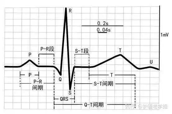 >>正常心电图的波形及其意义