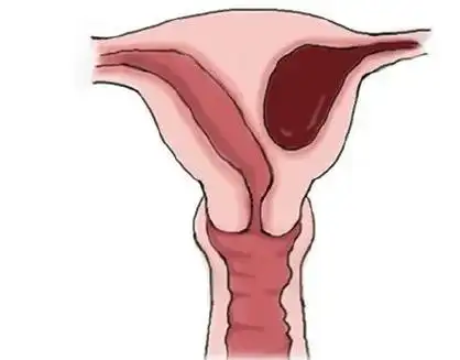 宫颈|小玲|纵膈|子宫内膜_网易订阅