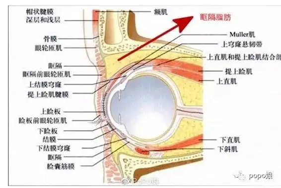 到底怎样才能让肿眼泡彻底消失?
